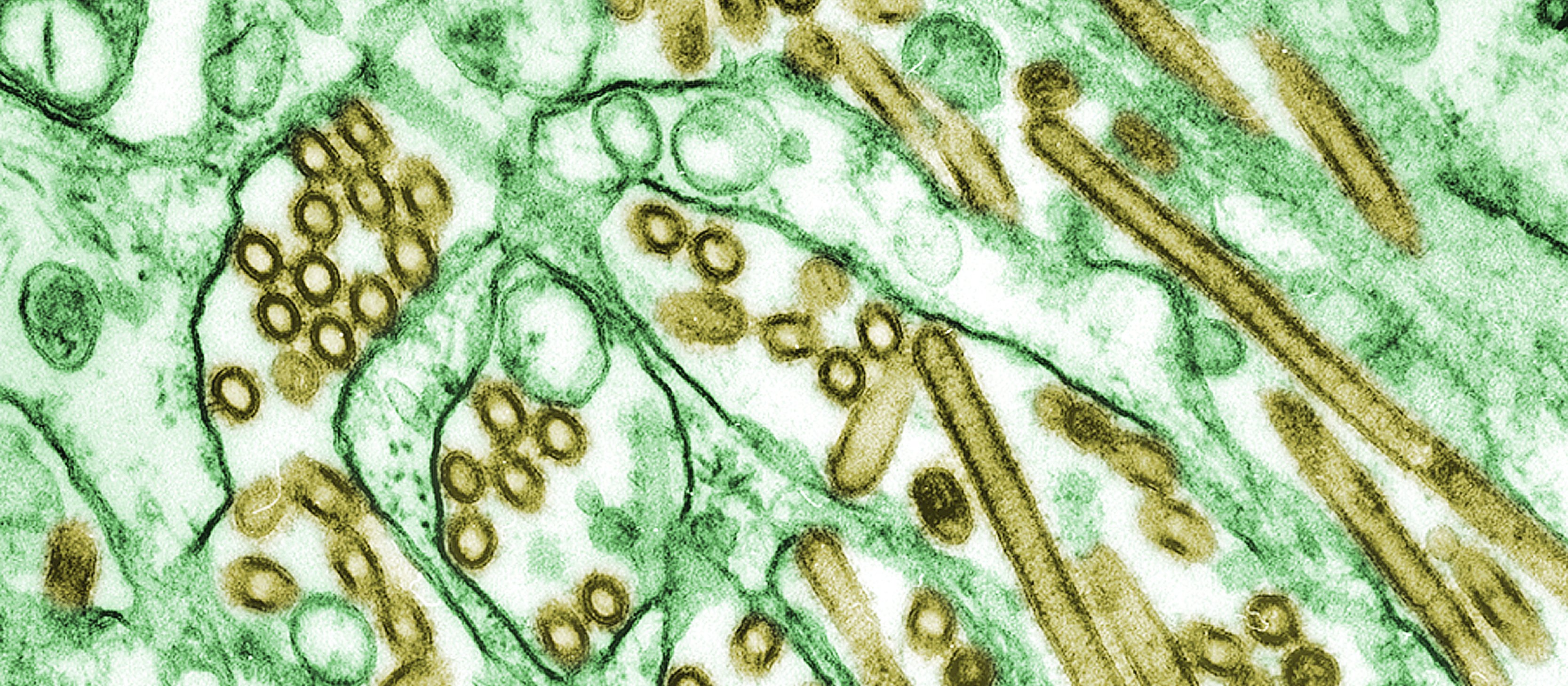 Flu, H5N1
