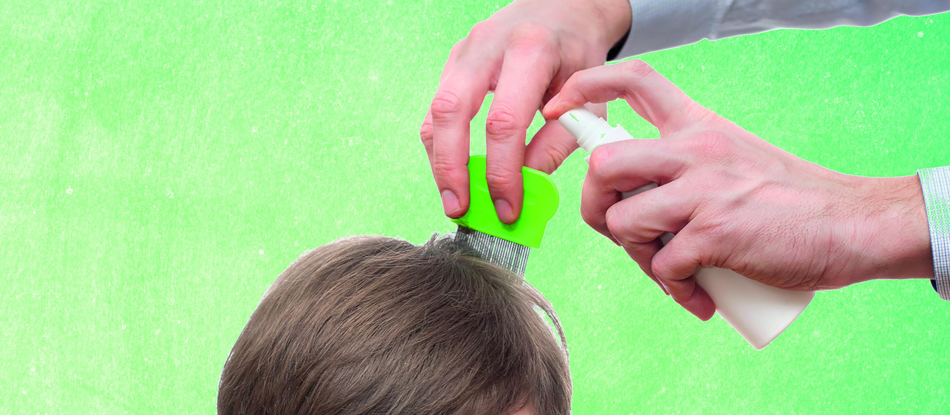 Boy with lice