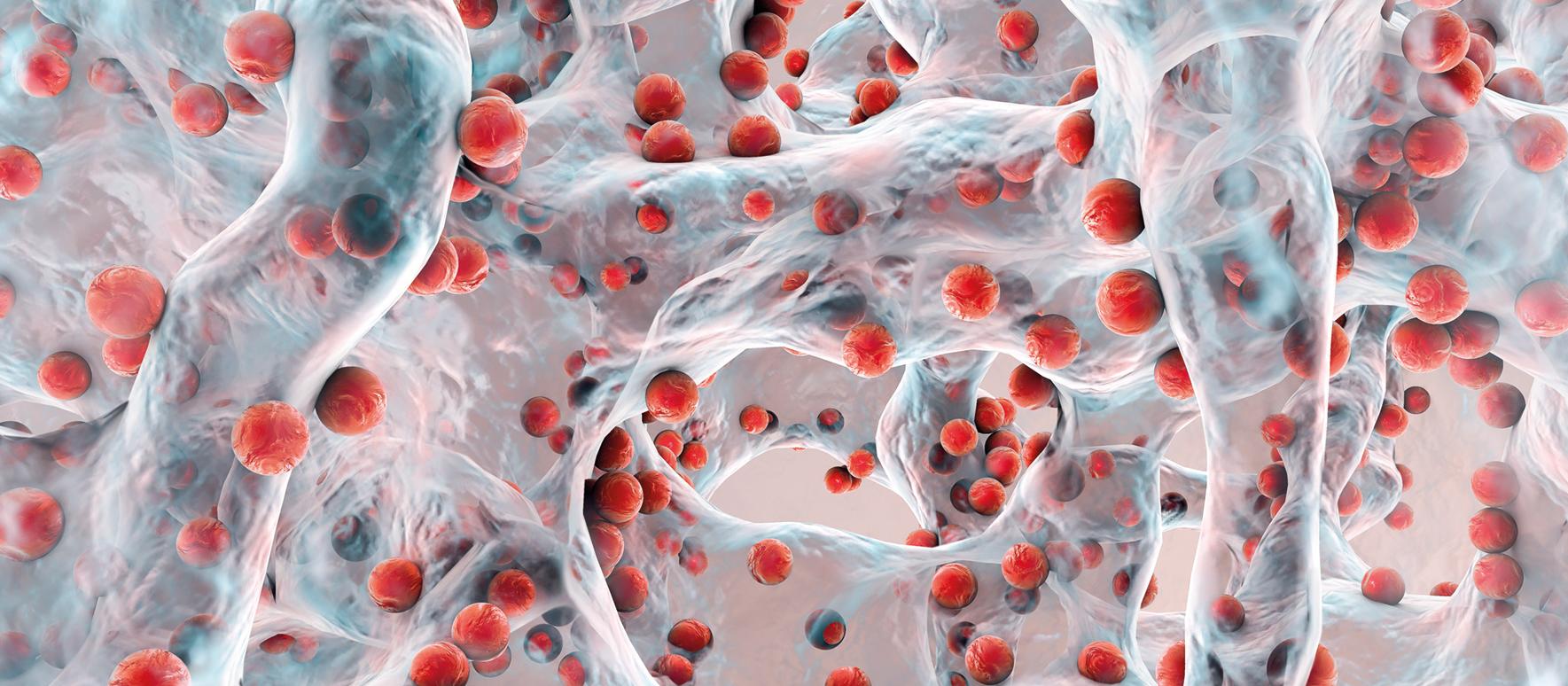 Antibiotic resistance
