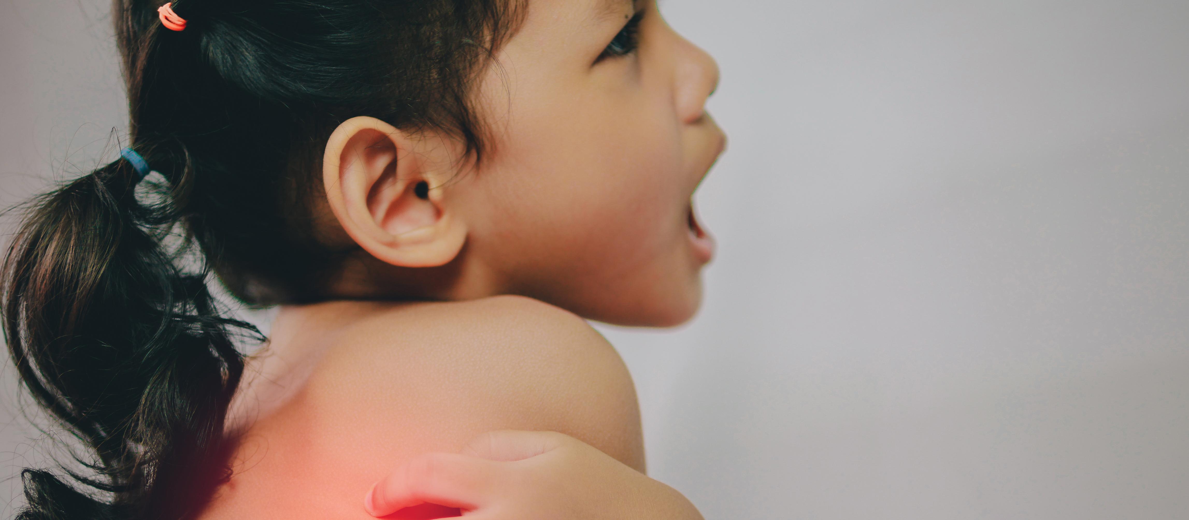 Maori pasifika child itchy eczema