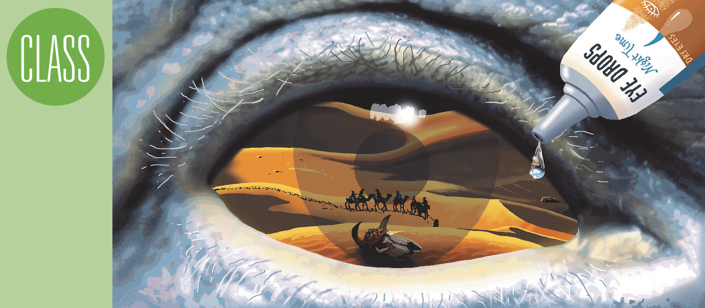 Dry eye disease