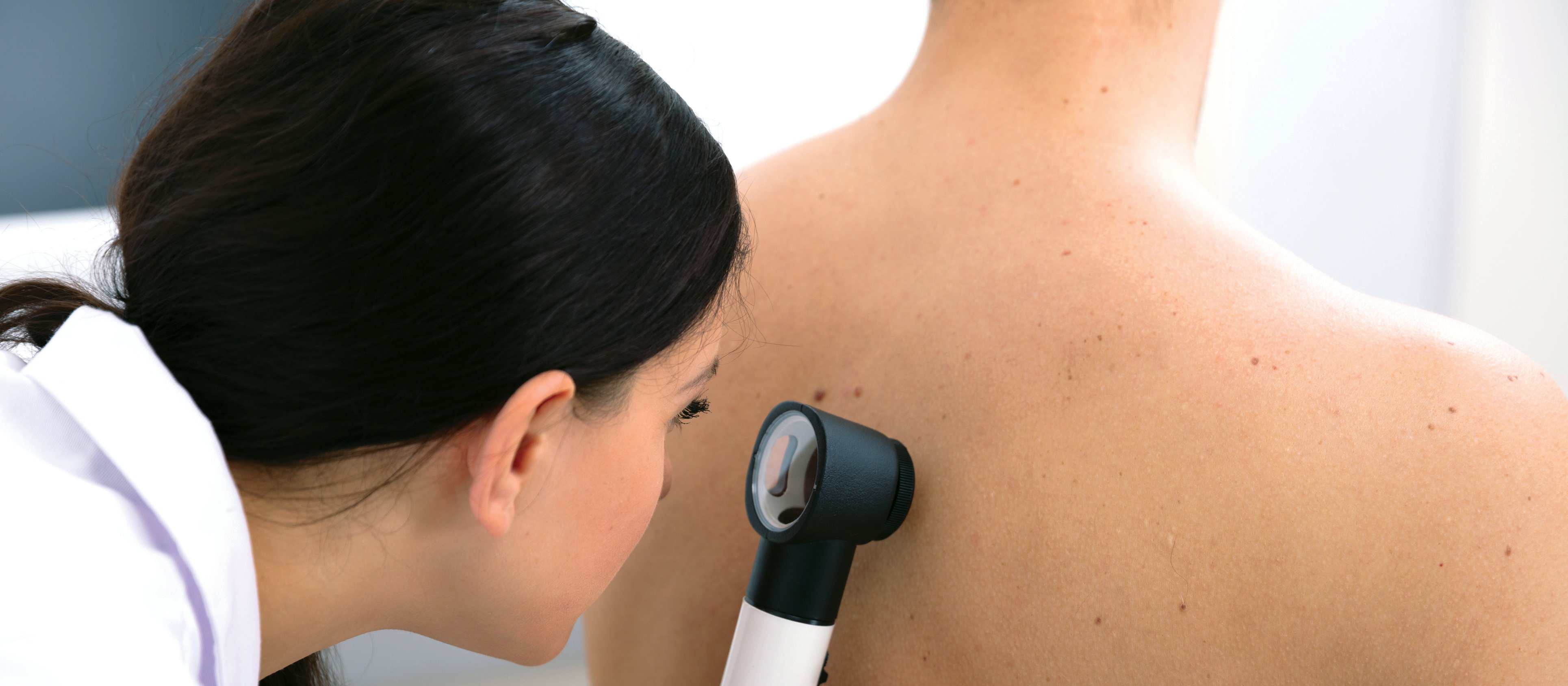 Exposure to ultraviolet radiation is the main environmental factor behind all forms of skin cancer (Image: iStock.com – Andrey Popov)