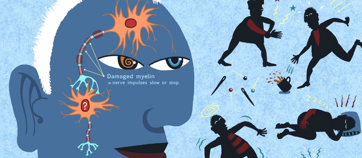 HTM Multiple Sclerosis