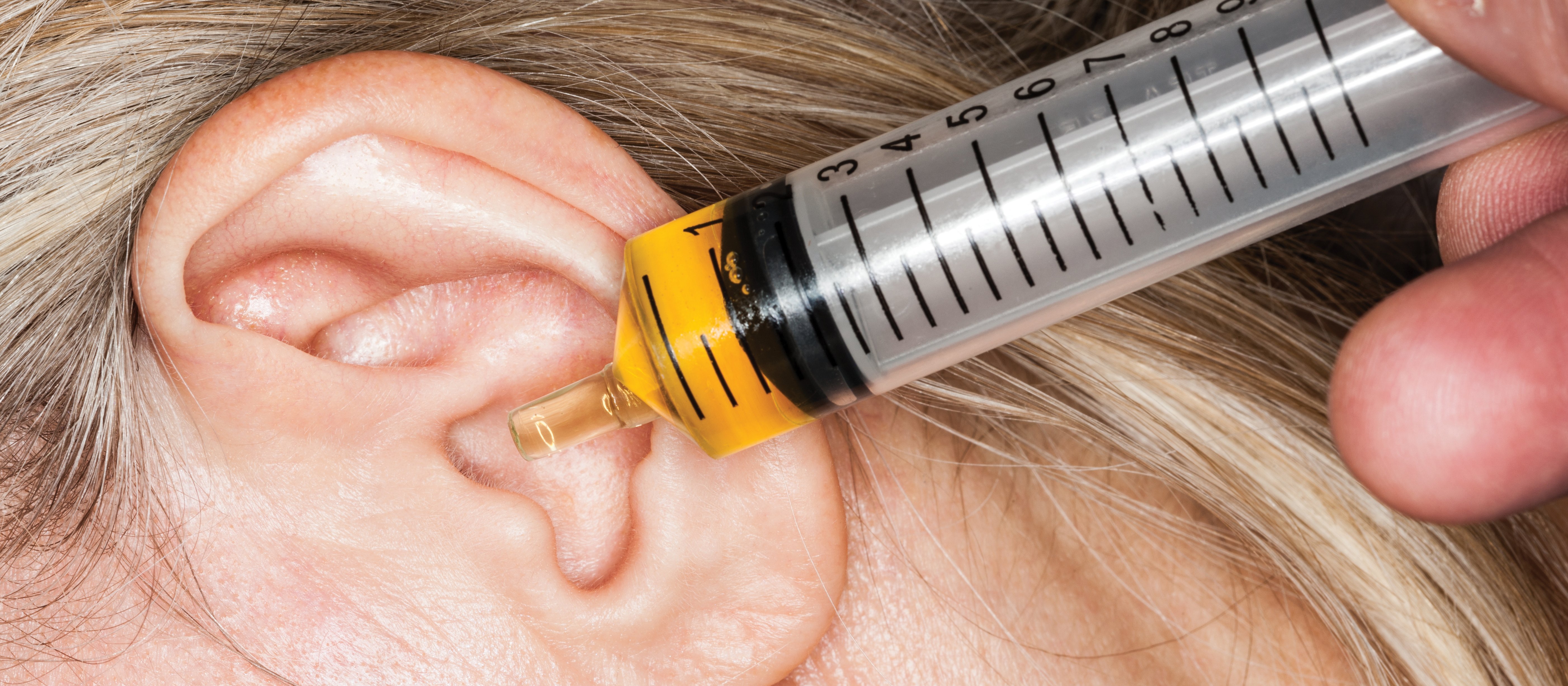 Softening earwax with olive oil