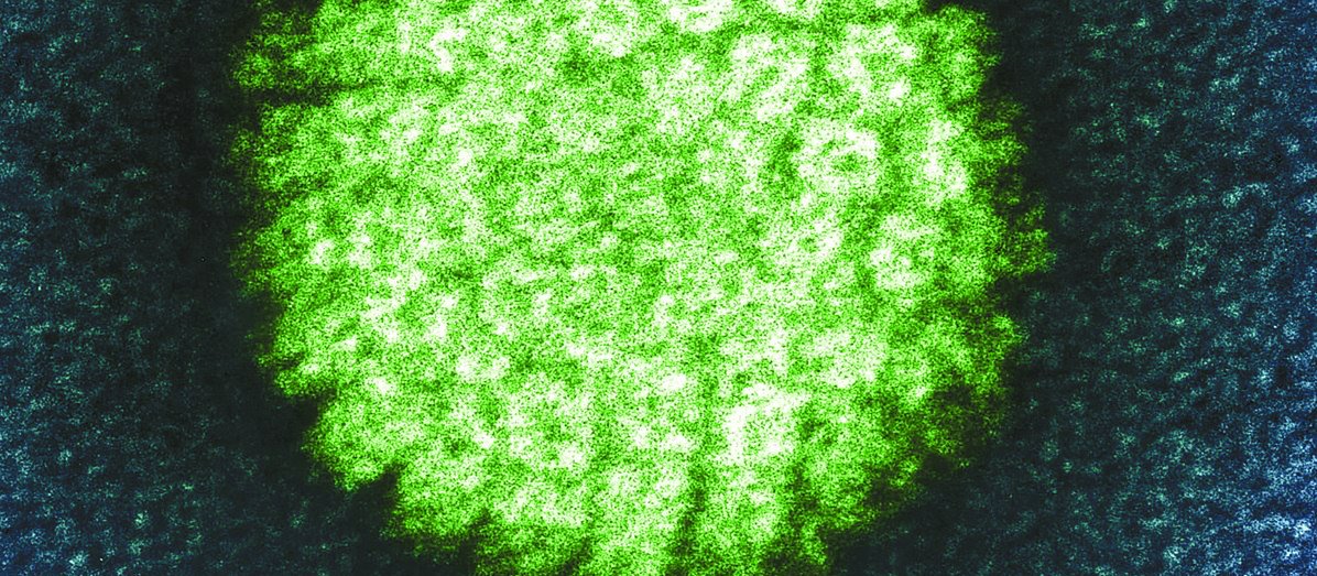 HPV_Virus_CR_PHOTOLIBRARY