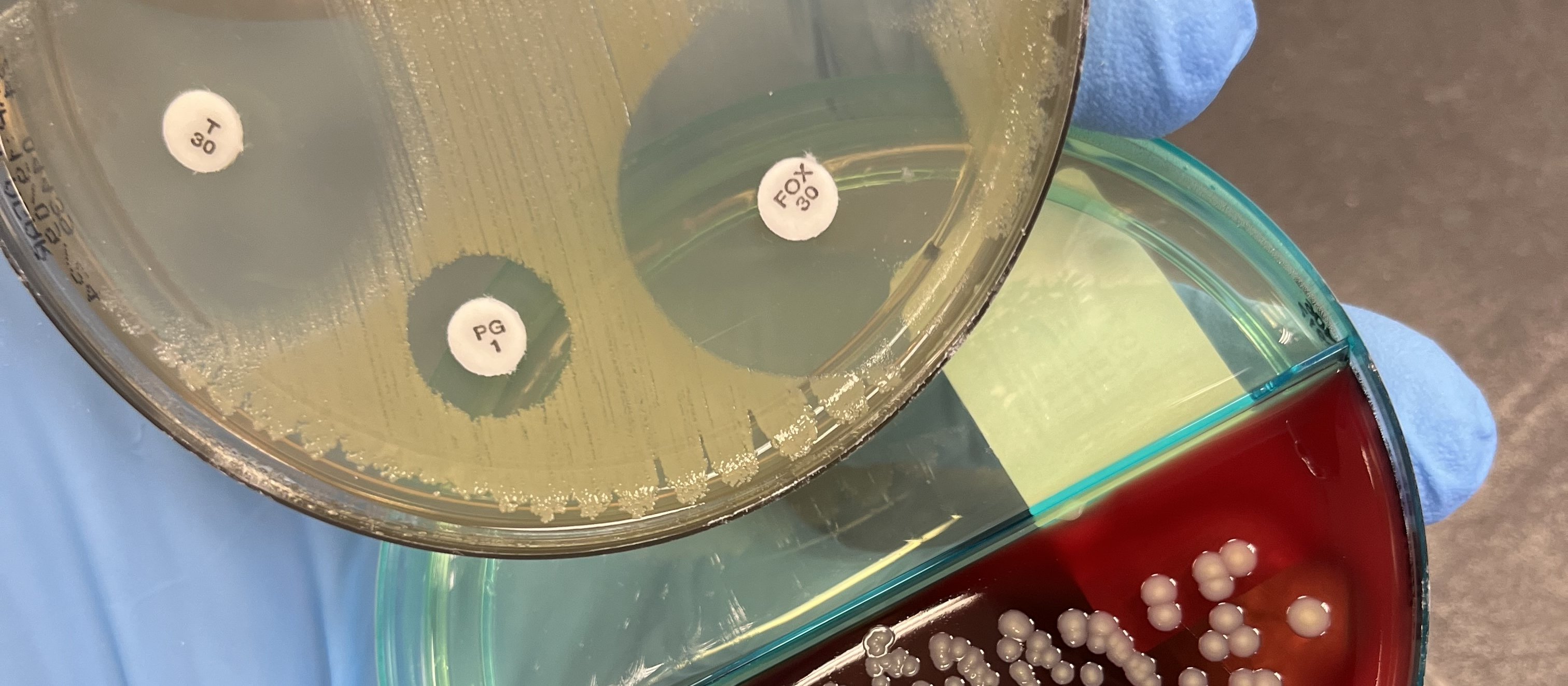 Methicillin-sensitive Staphylococcus aureus
