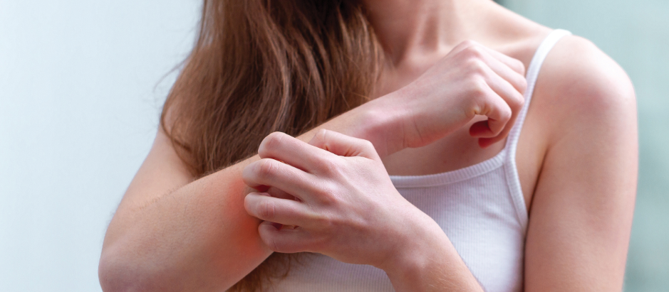 Woman_irritated_Skin_CR_Siarhei Khaletski_on_iStock-1499822896