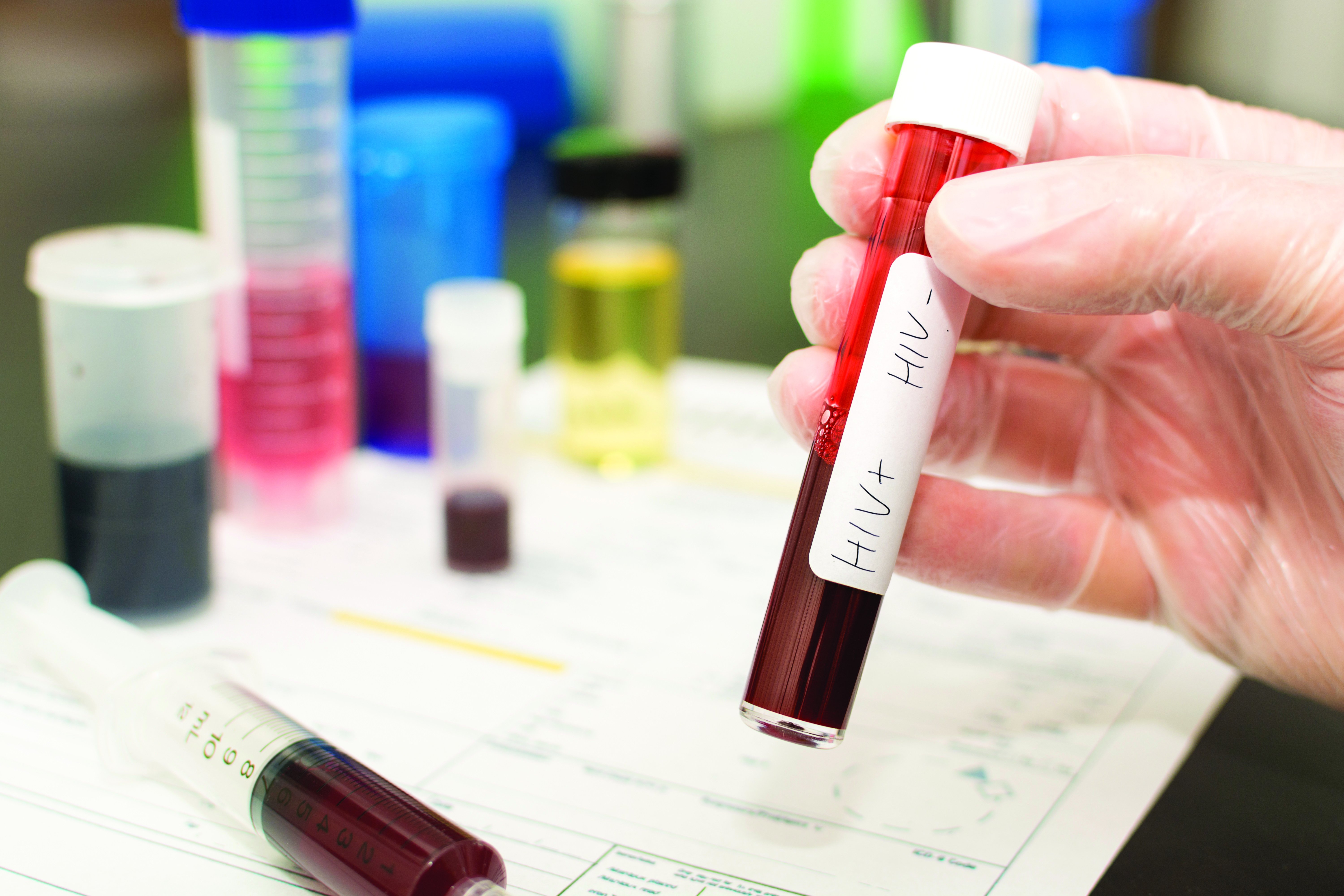 HIV blood test [Thomas Faull on iStock]
