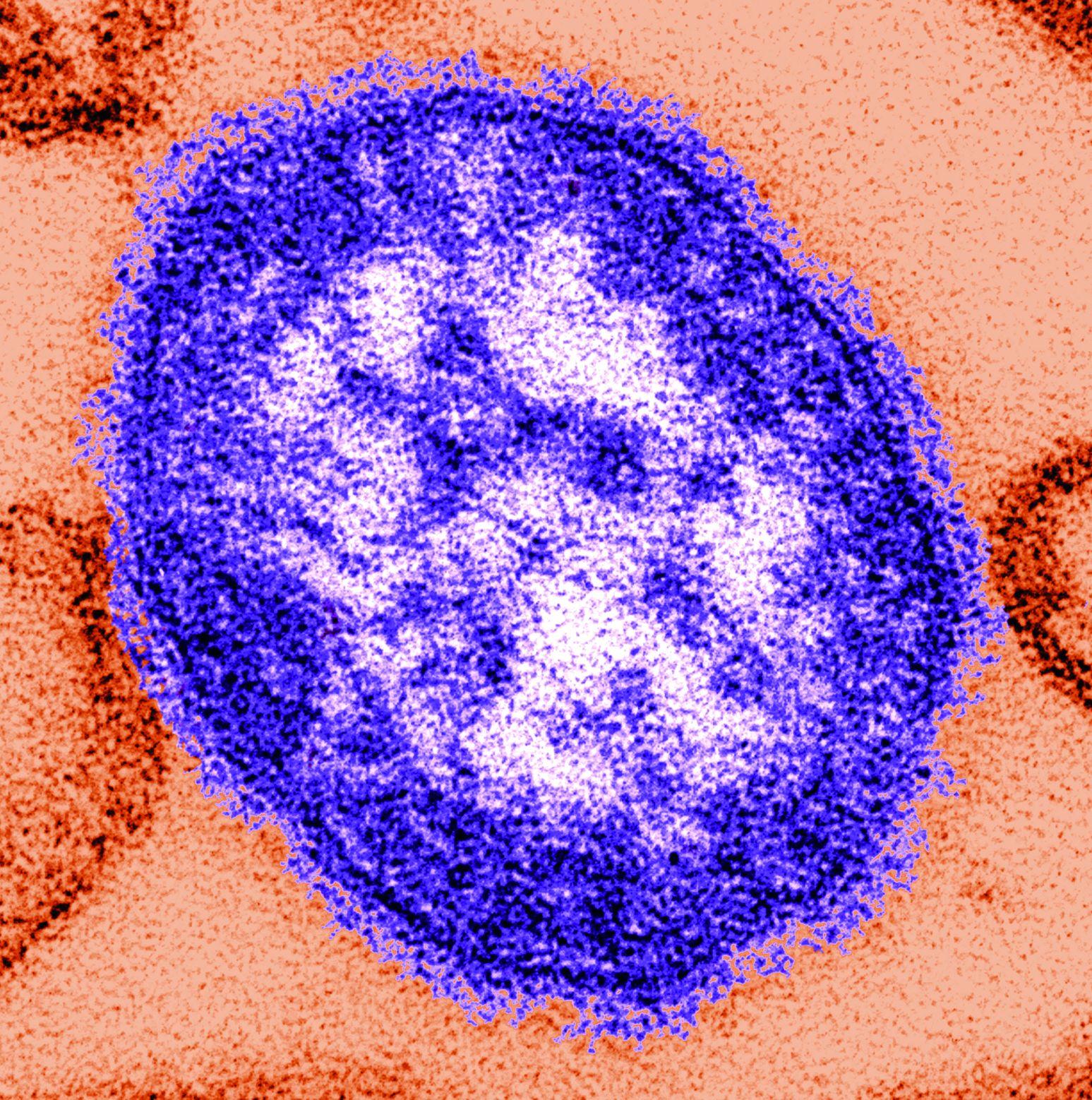 Measles serology