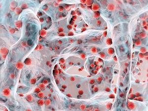 Antibiotic resistance