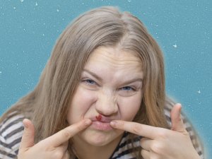 Woman cold sore