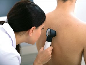 Exposure to ultraviolet radiation is the main environmental factor behind all forms of skin cancer (Image: iStock.com – Andrey Popov)
