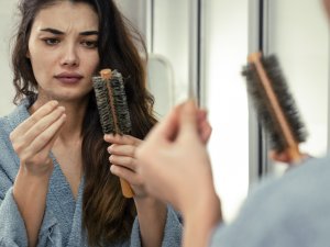 Hairloss woman