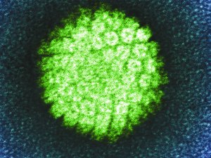 HPV_Virus_CR_PHOTOLIBRARY