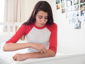 Young teen girl scratching arm