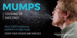 2017 mumps outbreak graphic