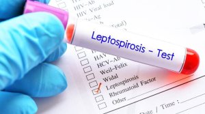 The Auckland Regional Public Health Service says there has been an increase in leptospirosis notifications over the past two weeks which may be linked to the recent weather events [Image: LDR]