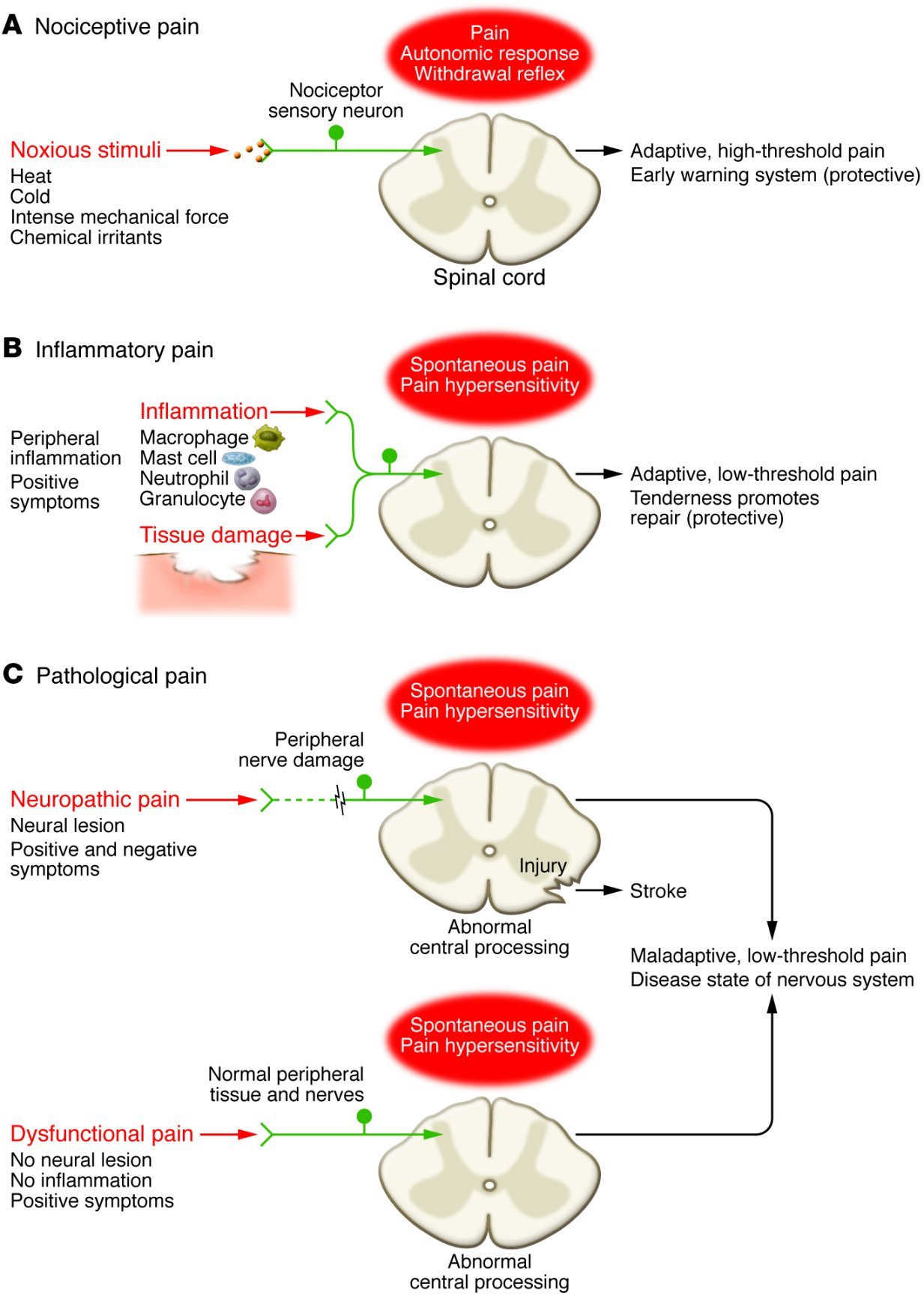 CLASS Persistent Pain Figure 1